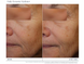 Антивозрастной увлажняющий крем с технологией GeneXC&reg; iS Clinical Daily Dynamic Hydrator, 50 г